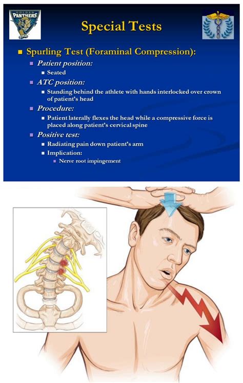 test for cervical nerve impingement